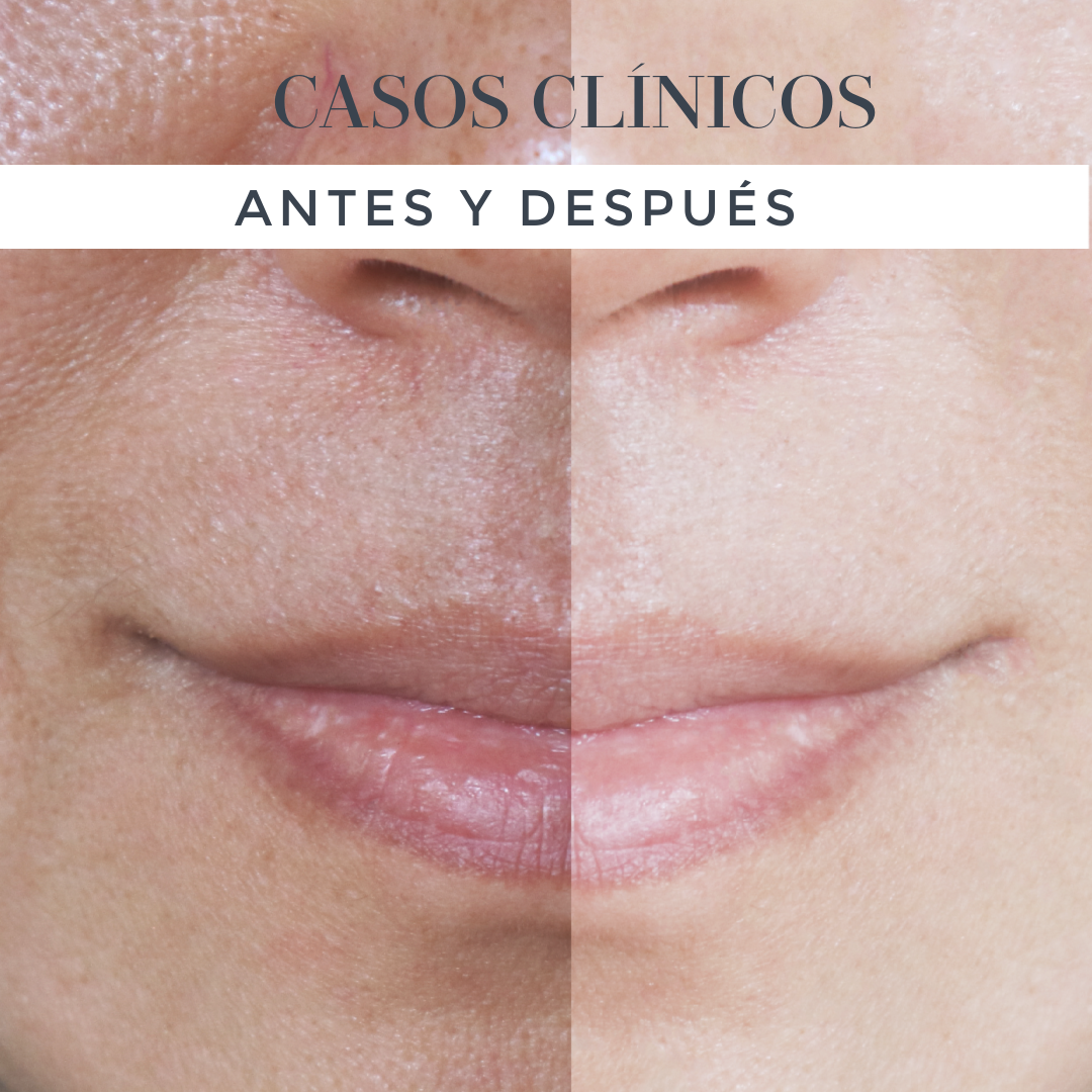 Casos Clínicos