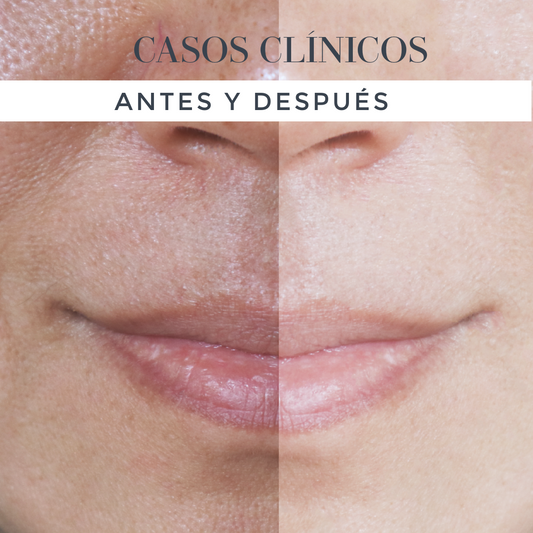 Casos Clínicos